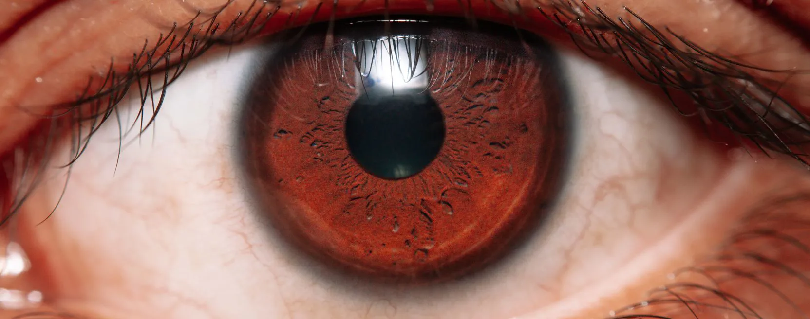 Oculistica e diagnostiche